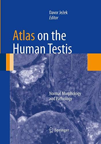 Histology of the human eye;: An atlas and textbook: Hogan, Michael